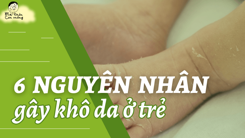Nguyen-nhan-gay-kho-da-o-tre-1